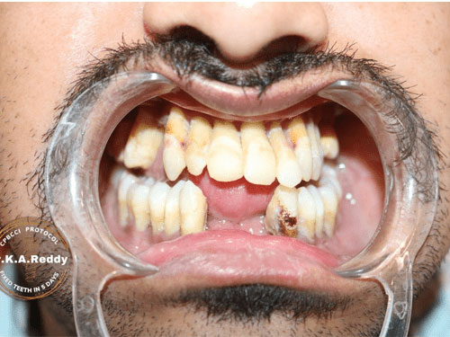 Dental Patients Case Studies
