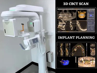 CBCT Scan