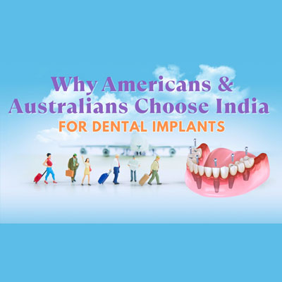 Why More Americans and Australians Are Choosing India for Dental Implants
