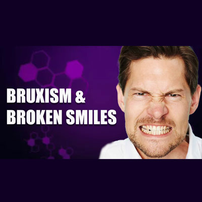 The Stress-Smile Connection: Understanding How Anxiety Triggers Bruxism and Dental Damage