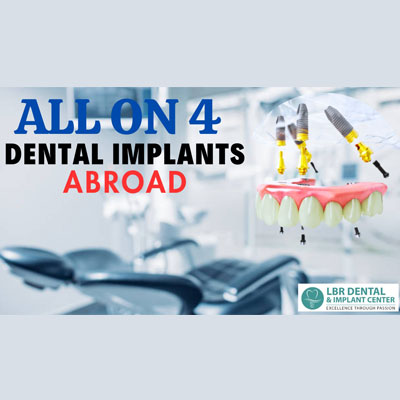 All-on-4 Dental Implants Abroad