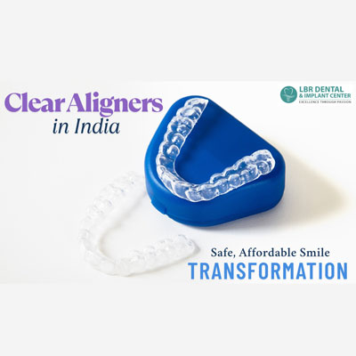 Clear Aligners in India: Why More International Patients Are Choosing India for Safe, Affordable Smile Transformations