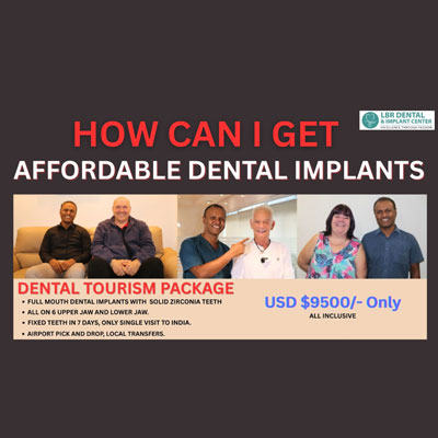 How Can I Get Affordable Dental Implants? A Complete Guide for International Patients