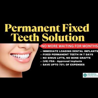 Permanent Fixed Teeth Solution