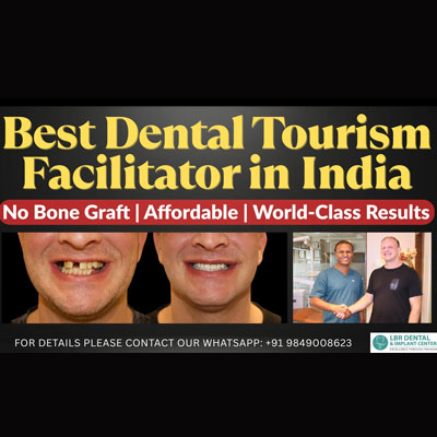 Best Dental Tourism Facilitator in India for Full-Mouth Dental Implants &Smile Makeovers