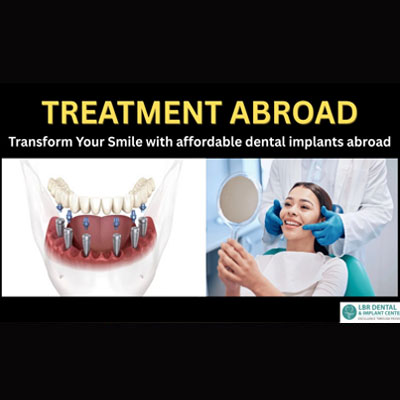 Treatment Abroad – Transform Your Smile with affordable dental implants abroad