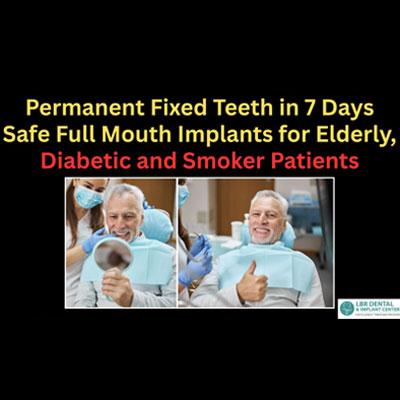 Permanent Fixed Teeth in 7 Days – Safe Full Mouth Implants for Elderly, Diabetic and Smoker Patients