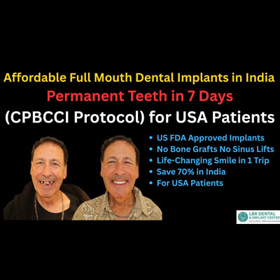 Affordable Full Mouth Dental Implants in India with CPBCCI Protocol