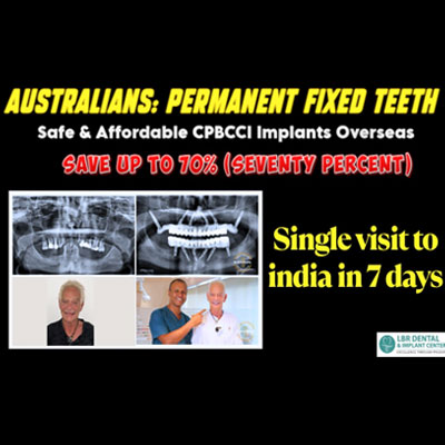 Australians Get Permanent Fixed Teeth in 7 Days – Safe & Affordable CPBCCI Full Mouth Implants Overseas