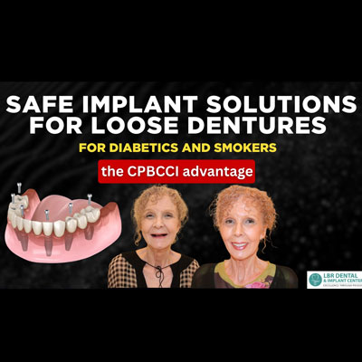 Safe Implant Solutions for Loose Dentures in Diabetics and Smokers – The CPBCCI Advantage