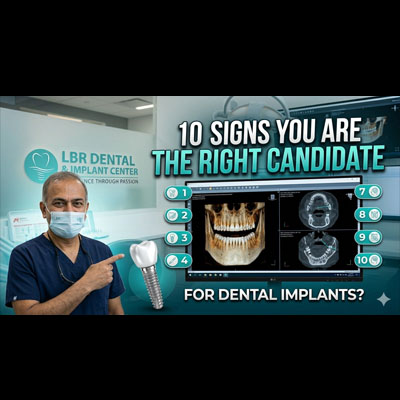 10 Signs You Are the Right Candidate for Dental Implants