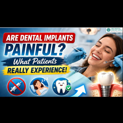 Are Dental Implants Painful? What Patients Really Experience