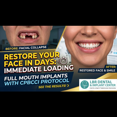 From “Untreatable” to Unstoppable:Full Mouth Dental Implants Transformation in India