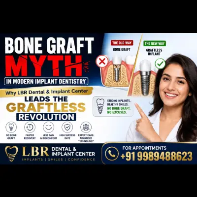 Bone Graft Myth in Modern Implant Dentistry