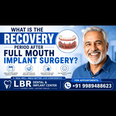 What Is the Recovery Period After Full Mouth Implant Surgery?