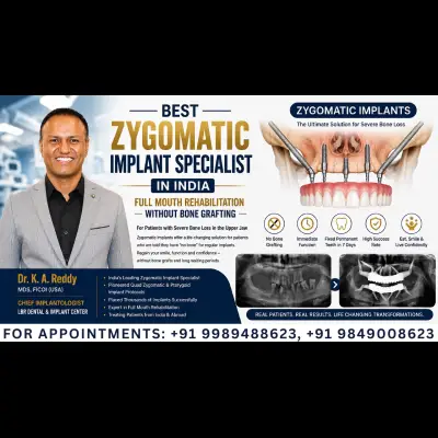 Best Zygomatic Implant Specialist in India |