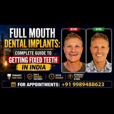 Full Mouth Dental Implants:Complete Guide to Getting Fixed Teeth in India