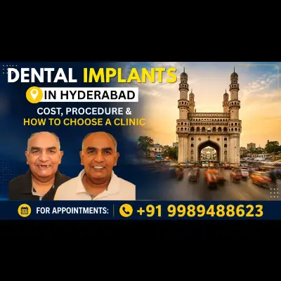 Dental Implants in Hyderabad: Cost, Procedure & How to Choose a Clinic
