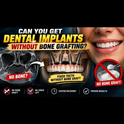 Can You Get Dental Implants Without Bone Grafting?
