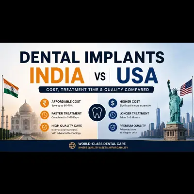 Dental Implants in India vs USA: Cost, Treatment Time & Quality