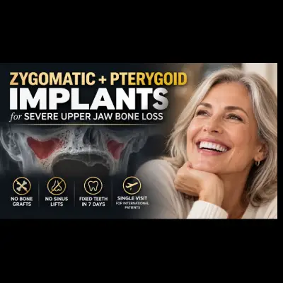 Zygomatic and Pterygoid Implants for Severe Upper Jaw Bone Loss